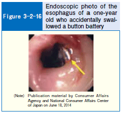 Figure 3-2-16 Endoscopic photo of the esophagus of a one-year old who accidentally swallowed a button battery