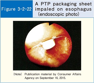 Figure-3-2-22 A PTP packaging sheet impaled on esophagus (endoscopic photo)