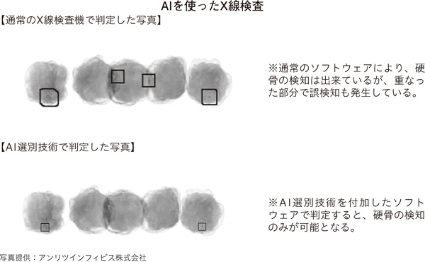 AIを使ったX線検査