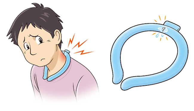 ネッククーラーの首の裏の部分から内容物が漏れ出しているため、その着用者の首の裏の皮膚がかぶれています。